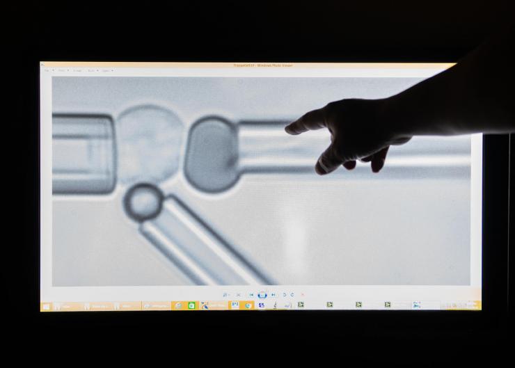 <p>Under the microscope, tiny pipettes tug at living cells to exert forces on their structures, measure those forces and observe the consequences for the cells. Credit: Georgia Tech / Allison Carter</p>