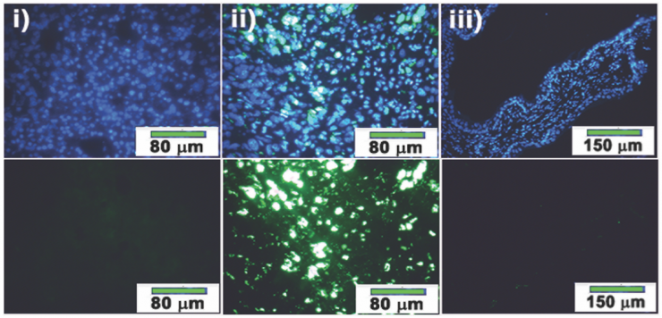 <p>A green glow confirms to researchers that the patented nanohydrogel met its mark in cancerous cells in vivo in mice in John McDonald's Georgia Tech lab. </p>