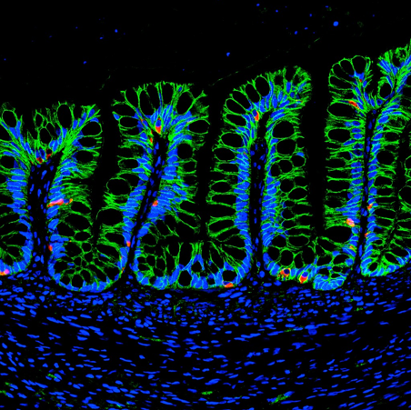 <p>Human intestinal organoids (HIOs) generated in the hydrogel matrix differentiate into mature intestinal tissue and present specialized human intestinal cell types, such as enteroendocrine cells (CHGA; red), after transplantation into an animal. (Credit: Miguel Quirós, University of Michigan)</p>