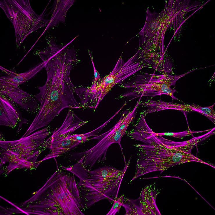 Human fibroblast cells