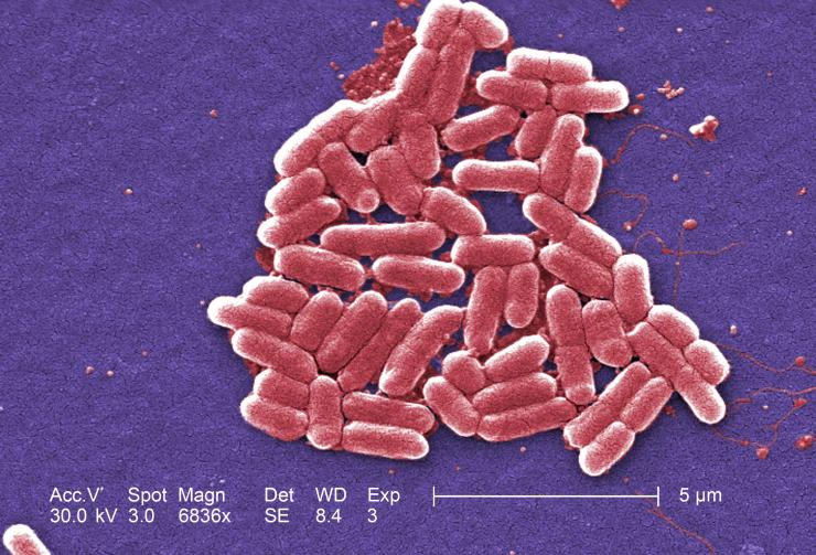 <p>Under high magnification, this digitally colorized scanning electron microscope image depicts a growing cluster of Gram-negative, rod-shaped, Escherichia coli bacteria, of the strain O157:H7, which is a pathogenic strain of E. coli. (Image: Centers for Disease Control and Prevention)</p>