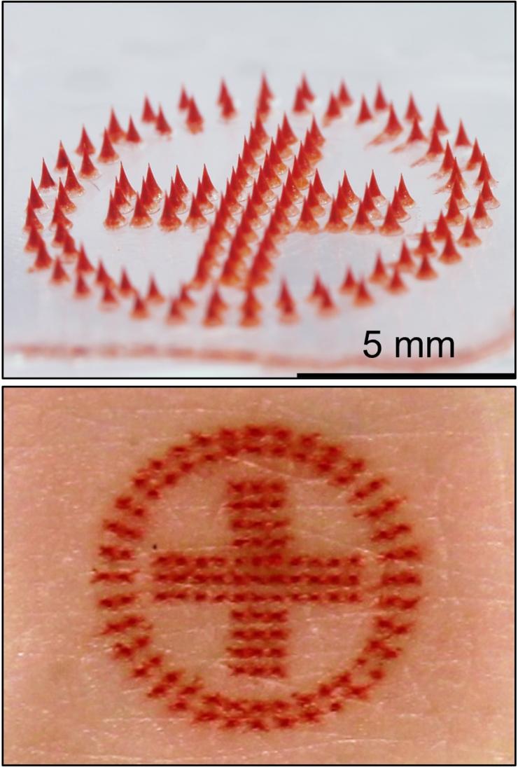 <p>Medical alert tattoo: microneedle patch (above) and tattoo on skin (below).</p><p>Credit: Song Li, Georgia Tech</p>