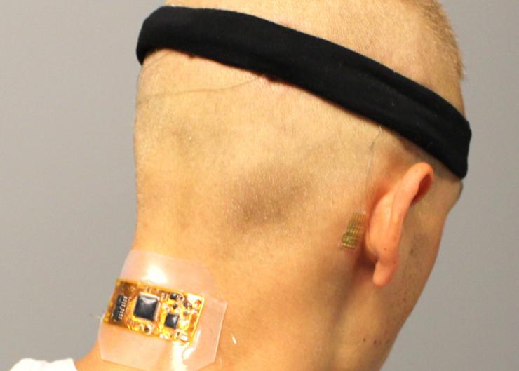 <p>Test subject who has flexible wireless electronics conformed to the back of the neck, with dry hair electrodes under a fabric headband and a membrane electrode on the mastoid, connected with thin-film cables. (Courtesy of Woon-Hong Yeo)</p>