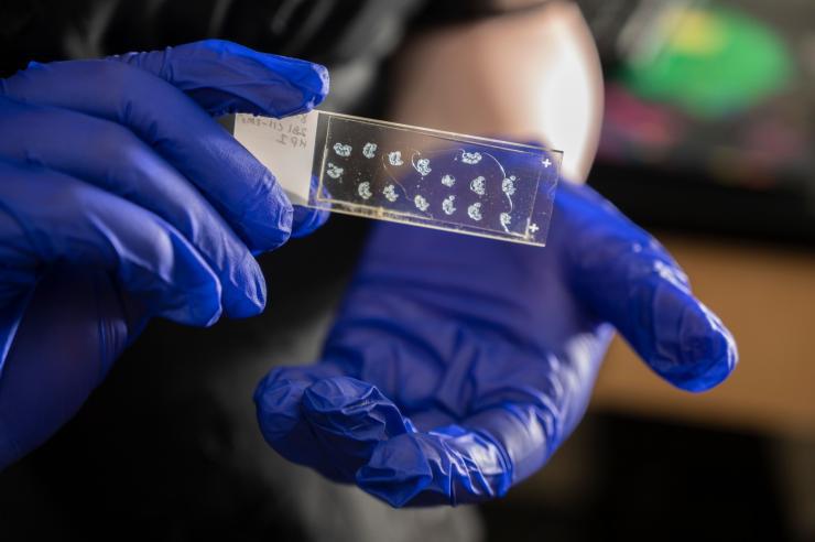 These mouse hindpaw sections allow Georgia Tech researchers to visualize skin nerves. (Photo Credit: Christopher Moore, Georgia Tech)
 