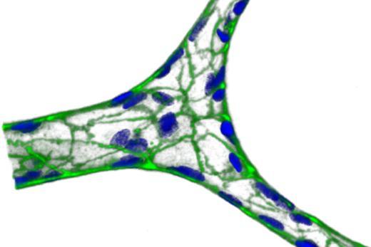 <p>A miniature blood vessel, formed on agarose/gelatin hydrogel. Green represents VE-cadherin, a protein that glues cells together, and blue is nuclei.</p>

<p><em>Courtesy of Yongzhi Qiu.</em></p>