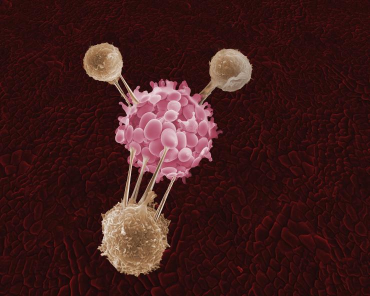 <p>Three T-cells attack a cancer cell in this artist's depiction.</p>

<p><em>Source: Getty Images / rights not transferable / not a press handout</em></p>