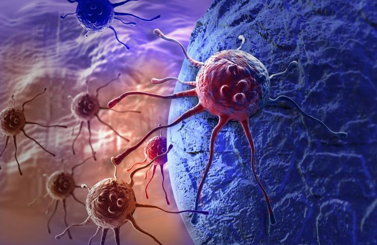 <p>Artist rendering of cancer cells wandering. Credit: Purchased from iStock to illustrate this story. Rights not transferable. </p>