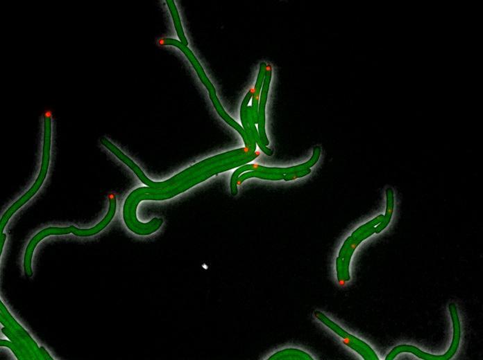 <p>Image shows E. coli cells under the stress of DHFR-targeting antibiotic trimethoprim in a 2015 study done prior to the research reported in this paper. The green color comes from GFP protein fused to DHFR and shows the uniform distribution of DHFR. The red color shows location of inclusion bodies of aggregated proteins in the cell. (Courtesy of Eugene Shakhnovich)</p>