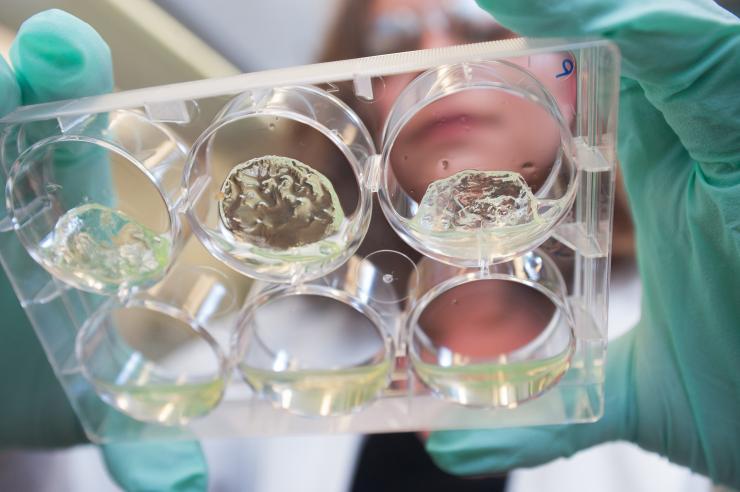 <p>Jessica Weaver, a postdoctoral researcher in Georgia Tech’s Woodruff School of Mechanical Engineering, holds a multiwell plate containing hydrogels with pancreatic islet cells. (Credit: Christopher Moore, Georgia Tech)</p>