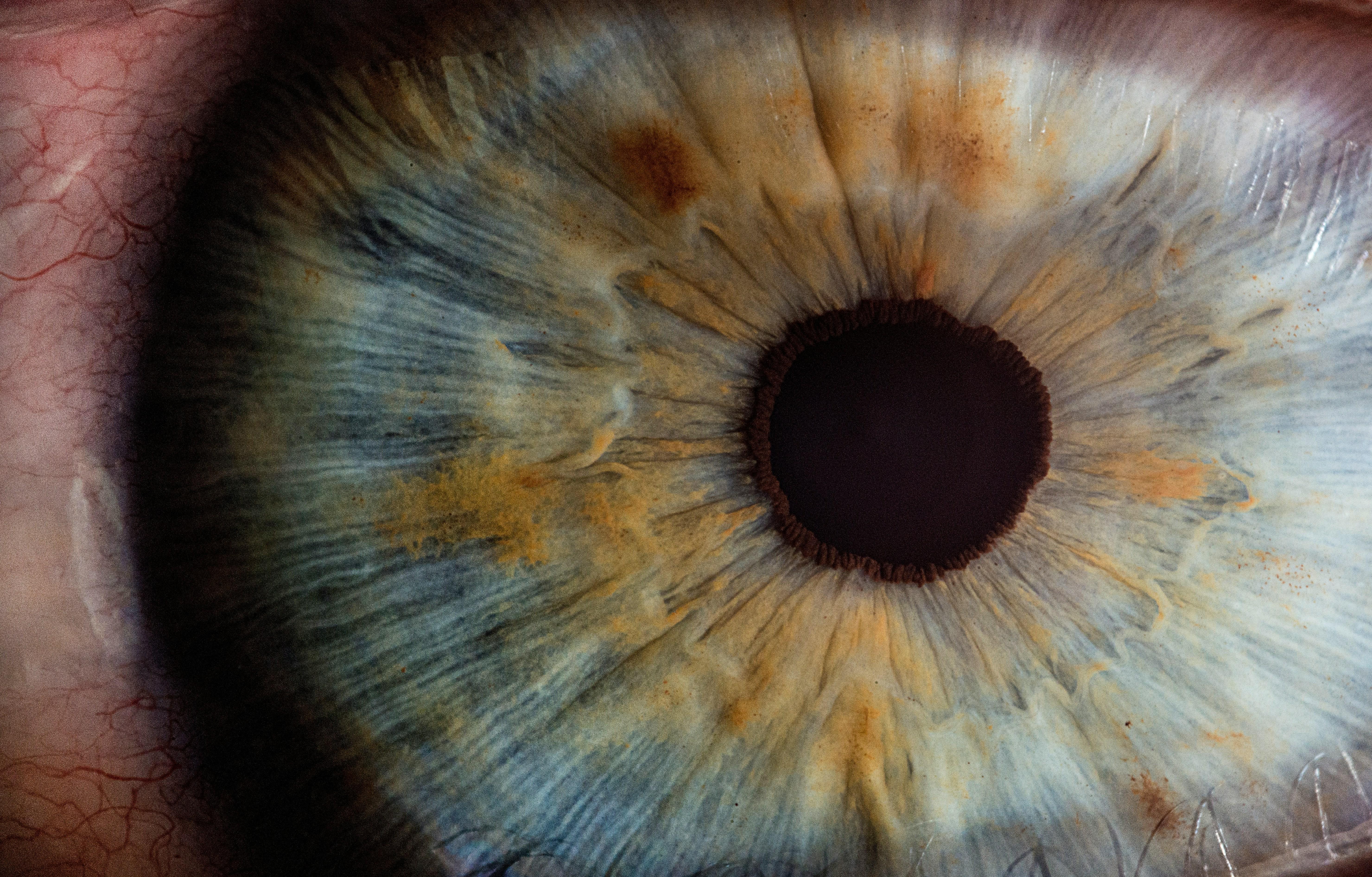 A human eye